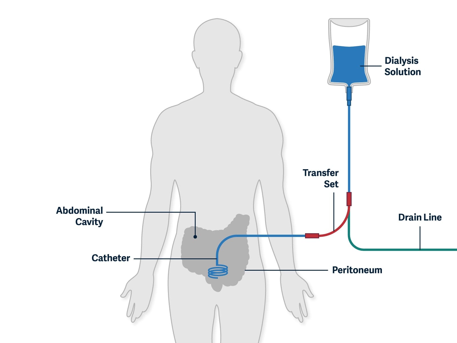 treatment-options-pure-life-renal-dialysis-centers